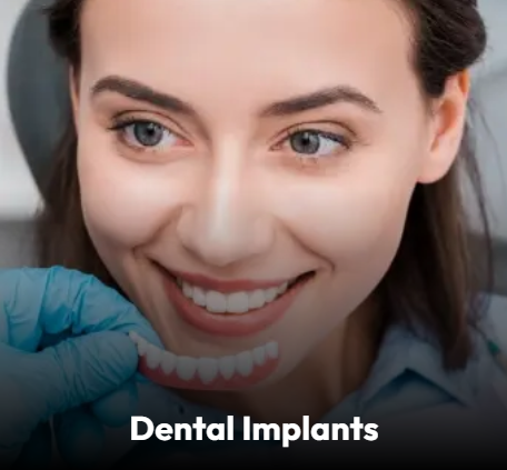 Dental Implants