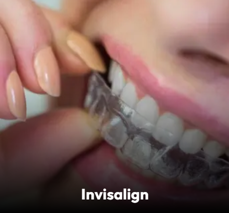 Invisalign